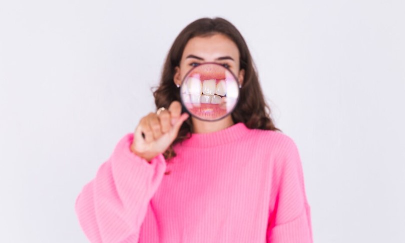 Kenali Crossbite, Deepbite, dan Openbite Sejak Dini 1 crossbite drg Ardianti