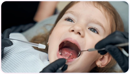 Penambalan Gigi 5 Close-up anak perempuan yang sedang diperiksa gigi oleh dokter gigi dengan instrumen dental, menunjukkan perawatan gigi anak yang cermat.