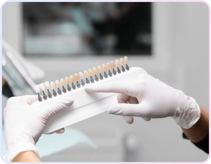 Veneer Gigi 2 Tangan dokter gigi bersarung tangan memegang panduan warna gigi (shade guide) untuk mencocokkan warna gigi pasien, menunjukkan presisi dalam prosedur veneer gigi.