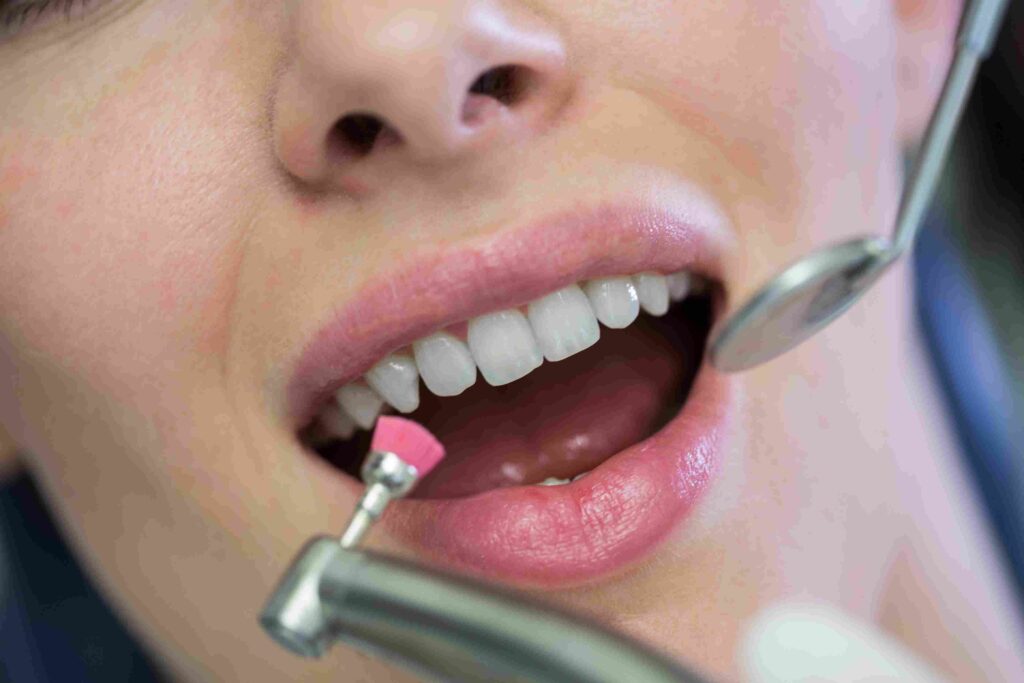 Mengenal Enamel Gigi dari Fungsi, Kerusakan, hingga Cara Melindunginya 2 Mengenal Enamel Gigi dari Fungsi, Kerusakan, hingga Cara Melindunginya