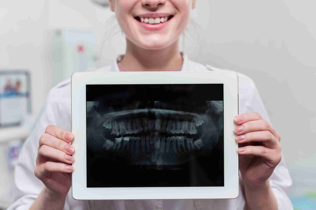 Peran Rontgen Gigi untuk Deteksi Dini Kesehatan Gigi dan Mulut 4 Peran Rontgen Gigi untuk Deteksi Dini Kesehatan Gigi dan Mulut